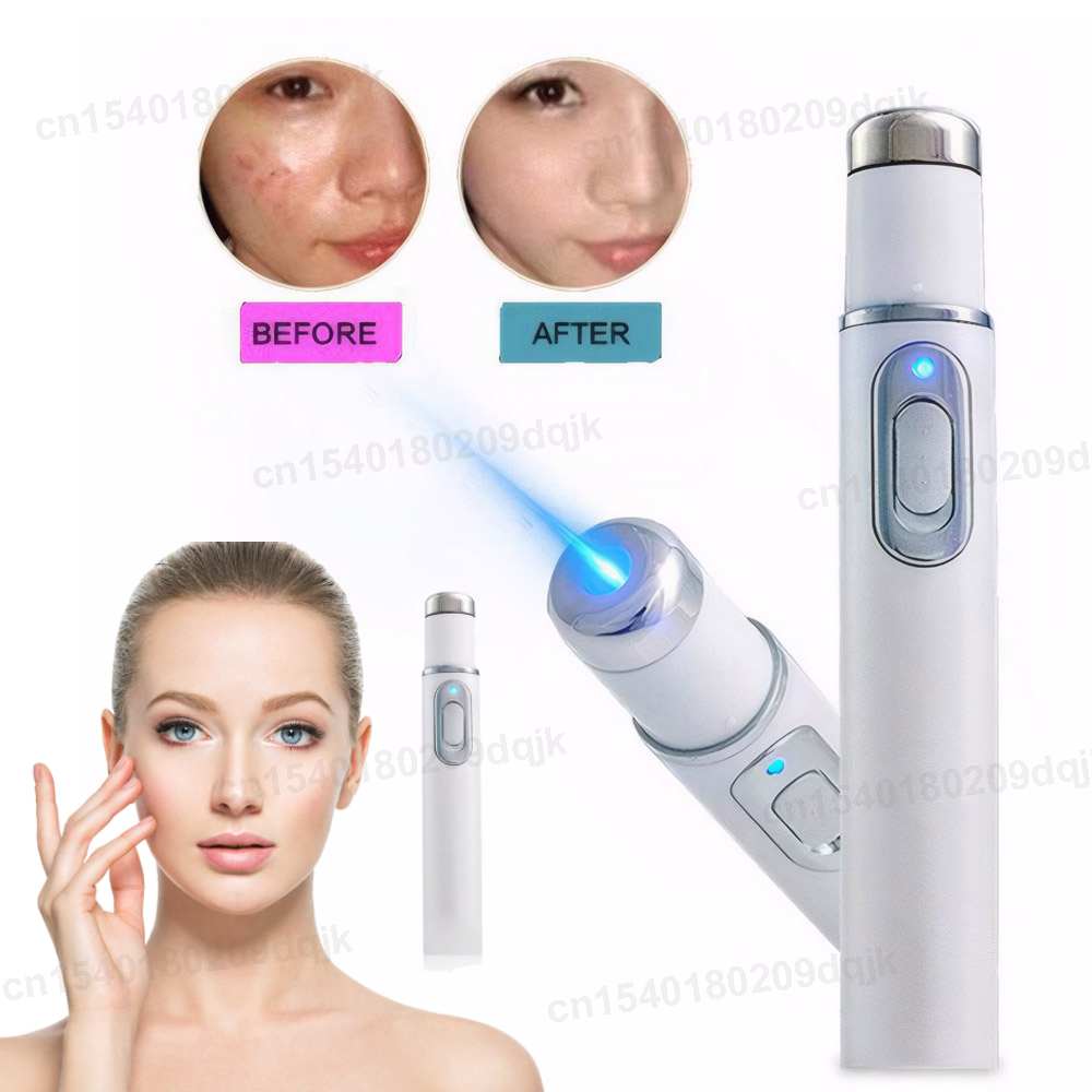 Acne Light Therapy Pen - Blue Light Therapy Acne Pen LED