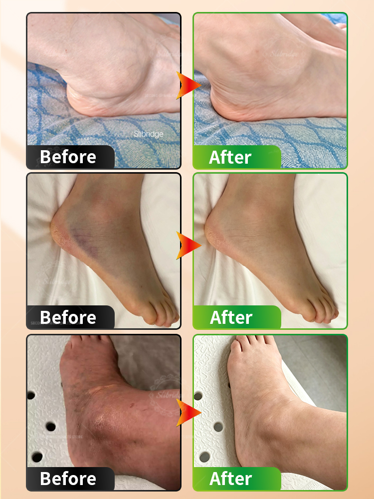 Portable Heated Ankle Massager - Ankle Brace Support ulasan dan harga